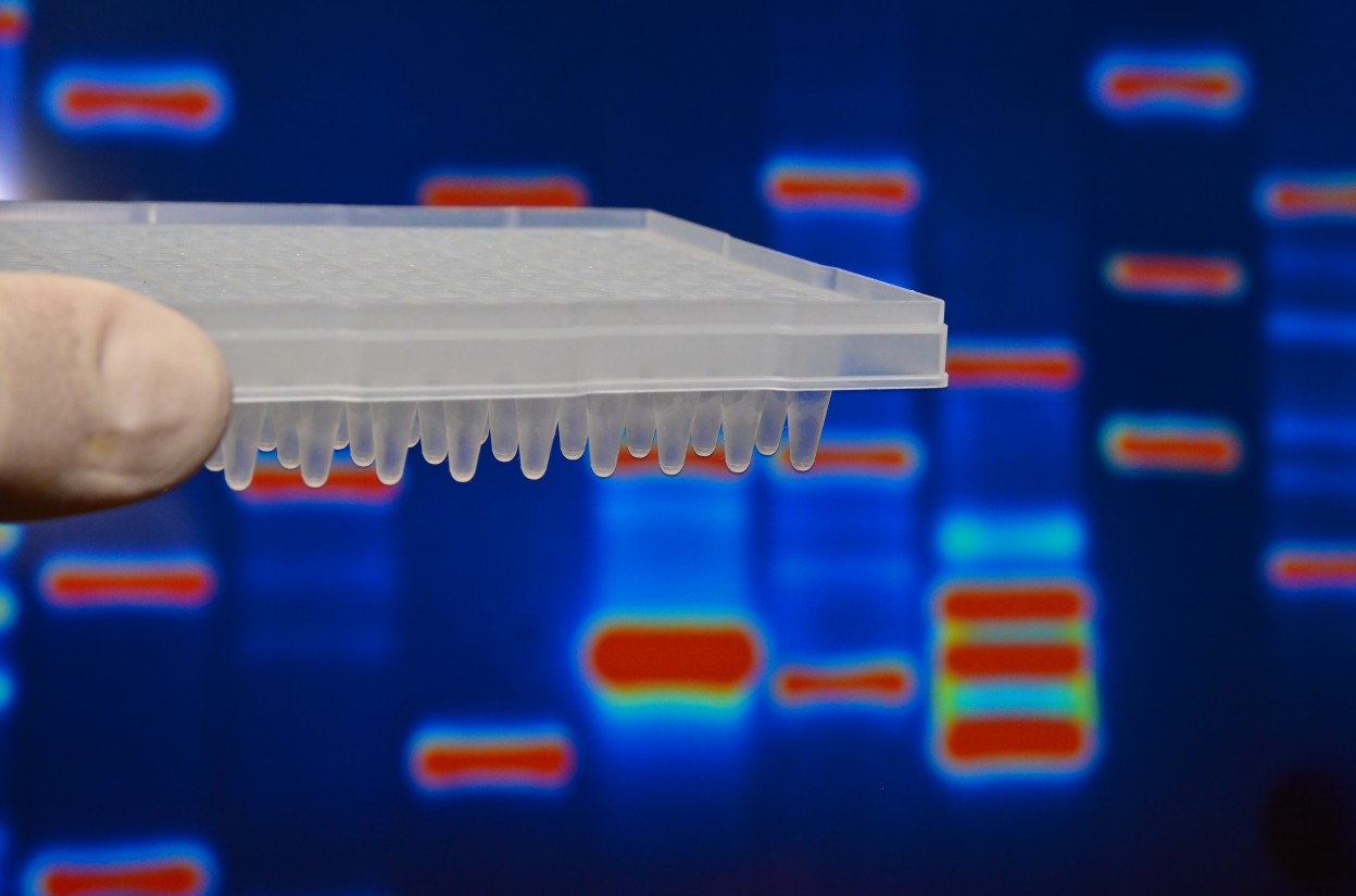 FXTAS biomarker