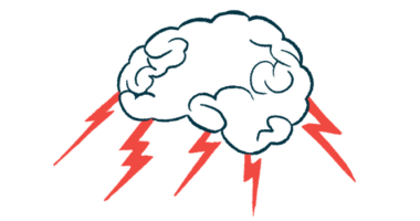 Lightning shoots out of a cloud-like brain.